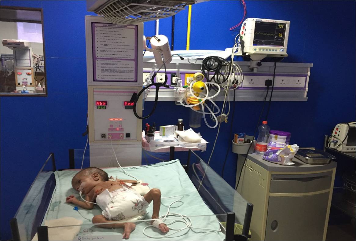 Dr. Sanjay Gandhi 2.5 kg child with ASD, VSD, and PDA