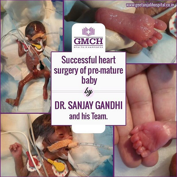 Successful heart surgeory by Dr. Sanjay Gandhi